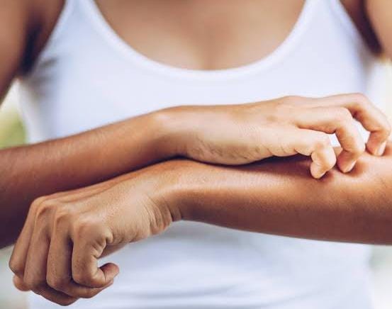 Alergia, irritação, infecção? saiba como identificar a causa de cada coceira