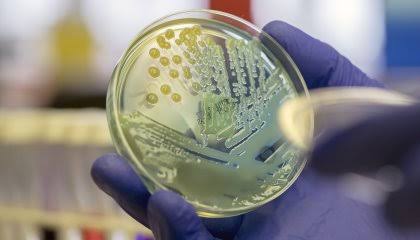 Super bactéria é detectada no Nordeste e representa risco global