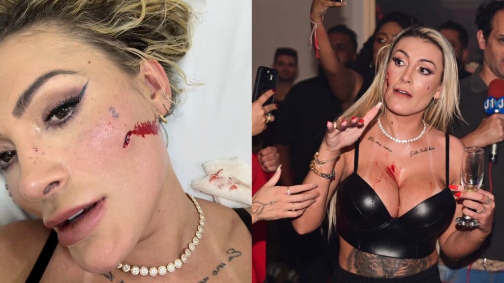 Andressa Urach acaba ensaguentada após briga com Juju Ferrari e vai parar no hospital