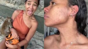 Influenciadora se desespera com alergia severa após mordida de macaco