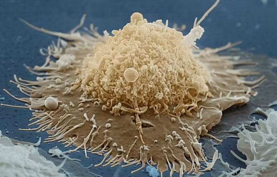 Ferramenta de IA pode diagnosticar diabetes, HIV e Covid de uma vez só
