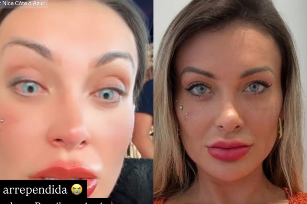 Andressa Urach confessa complicação e arrependimento após alterar cor dos olhos