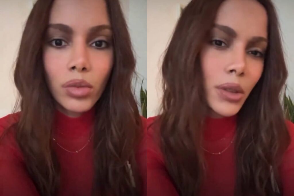 Anitta diz que mudança no rosto afetou novos projetos