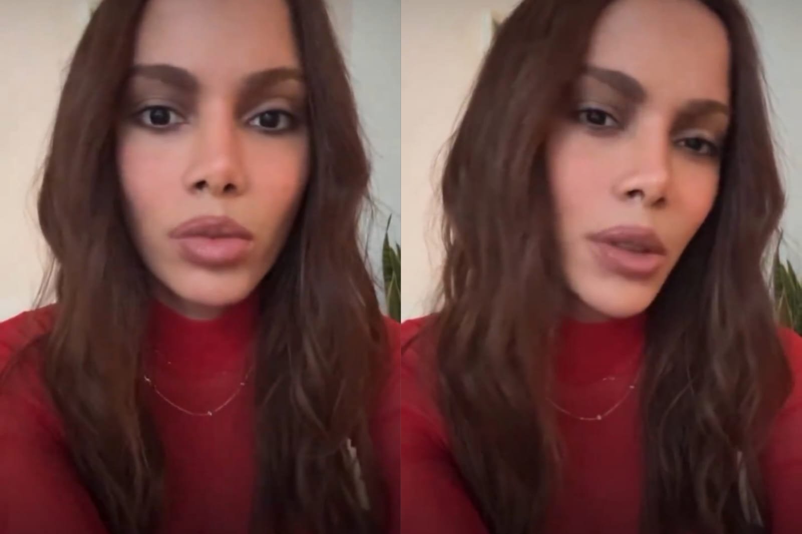 Anitta diz que mudança no rosto afetou novos projetos