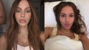 Após mudança de rosto, Anitta aposta em nova intervenção estética