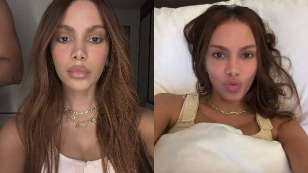 Após mudança de rosto, Anitta aposta em nova intervenção estética