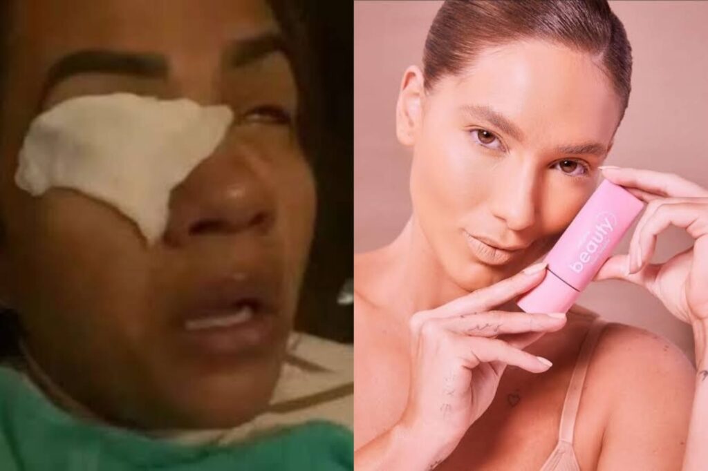 Mulher afirma que ficou cega após usar marca de Virginia Fonseca