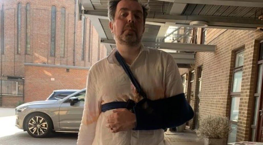 Maior pênis do mundo faz homem cair e quebrar o braço durante banho