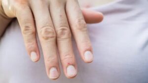 Suas unhas revelam muito sobre sua saúde; entenda os sinais