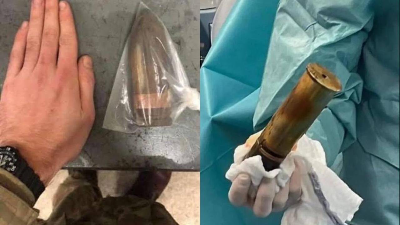 PRAZER DE GUERRA: jovem com projétil de 20cm no reto mobiliza esquadrão antibombas